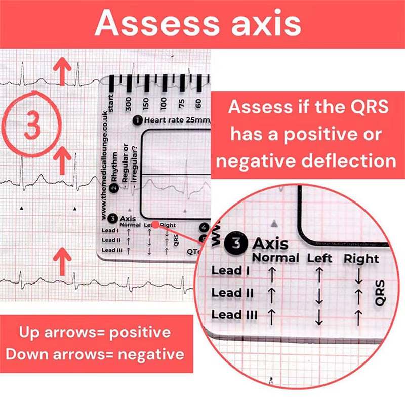 Ecg Transparent 7-Step Ruler Portable Ruler Card for Interpreting Ecg Ecg/Ekg Reference Guide Evaluation Tool Straight Caliper