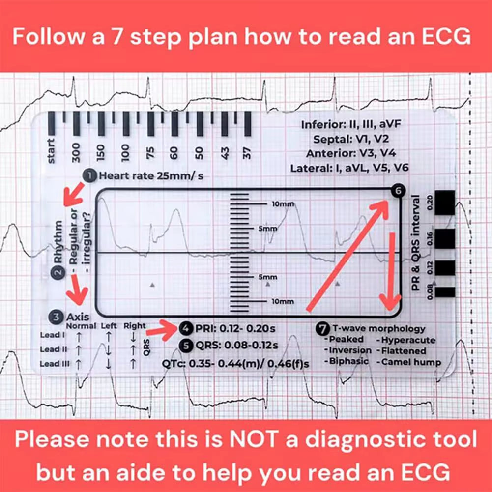 Ecg Transparent 7-Step Ruler Portable Ruler Card for Interpreting Ecg Ecg/Ekg Reference Guide Evaluation Tool Straight Caliper